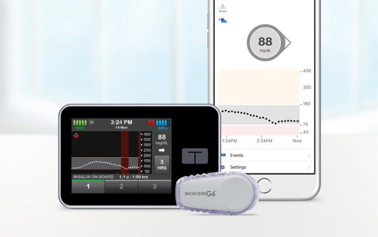 Tandem T-slim Control IQ Insulin Pump – Aim Plus Medical Supplies